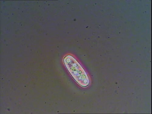 Image 2: Sarcoscypha austriaca spor1